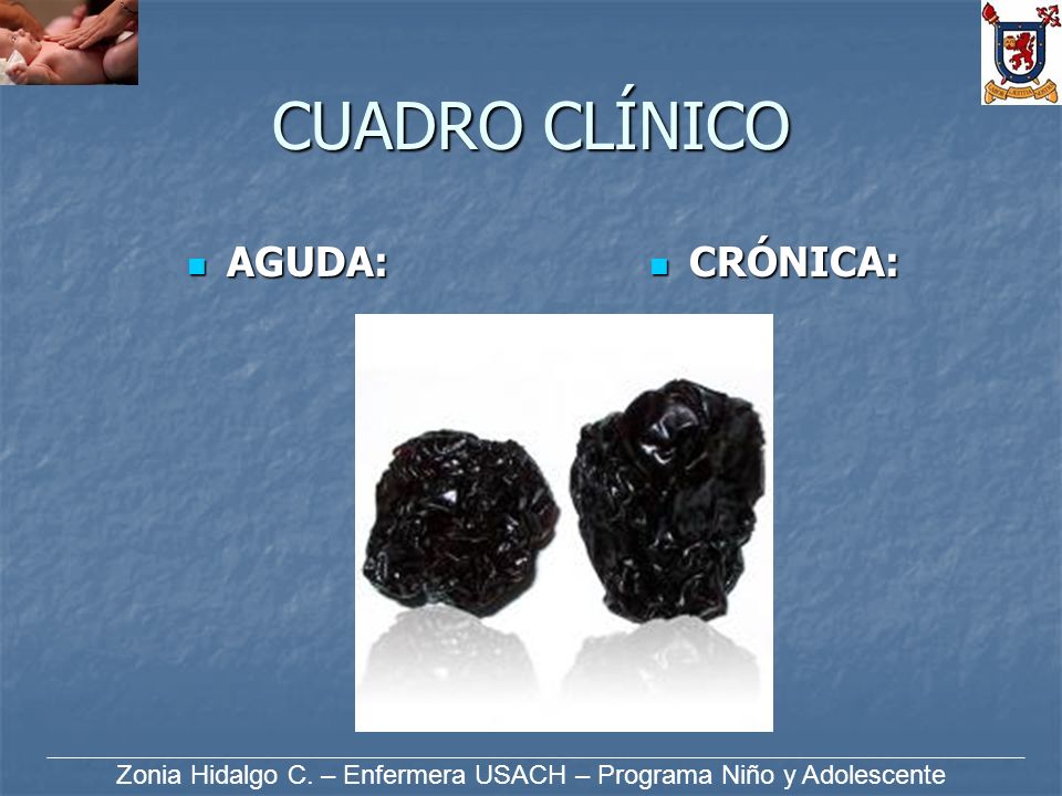 Zonia Hidalgo C. – Enfermera USACH – Programa Niño y Adolescente