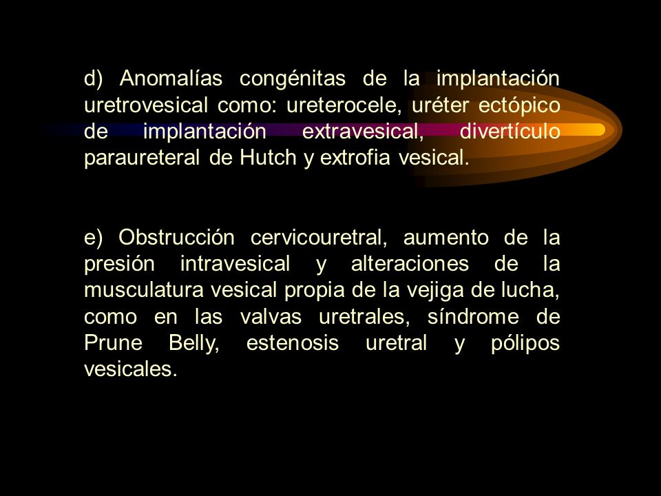 d) Anomalías congénitas de la implantación uretrovesical como: ureterocele, uréter ectópico de implantación extravesical, divertículo paraureteral de Hutch y extrofia vesical.