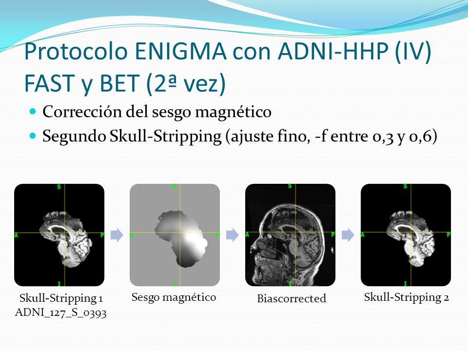 Protocolo ENIGMA con ADNI-HHP (IV) FAST y BET (2ª vez)