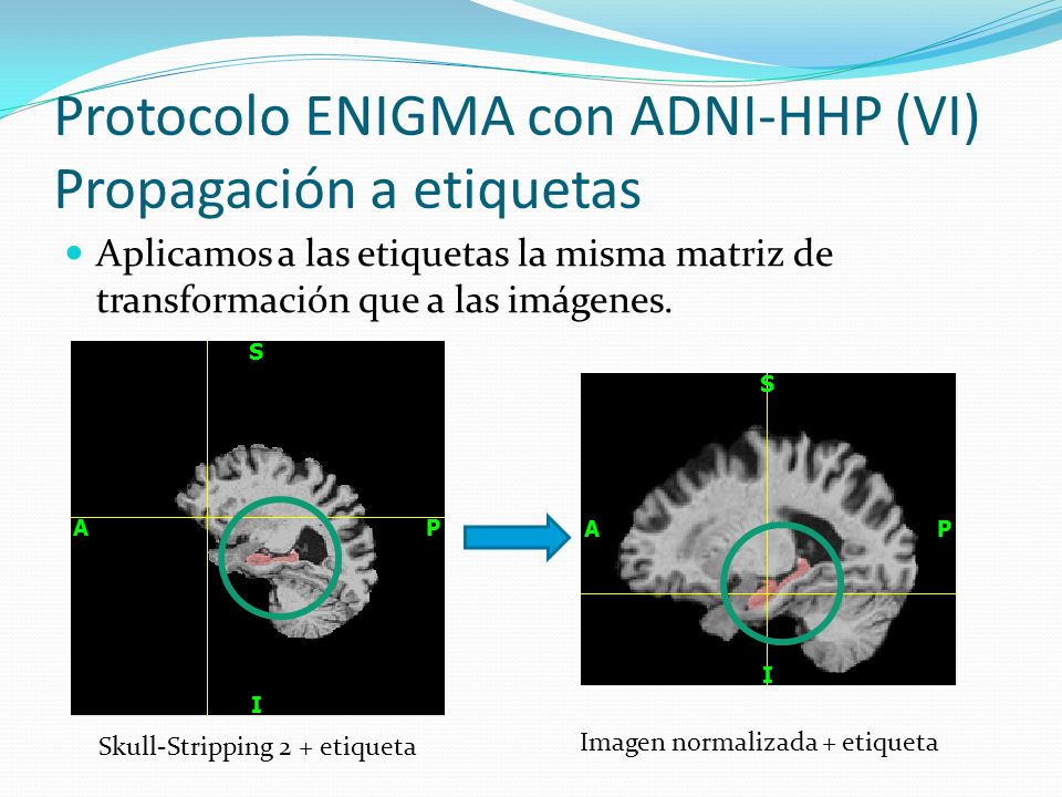 Protocolo ENIGMA con ADNI-HHP (VI) Propagación a etiquetas