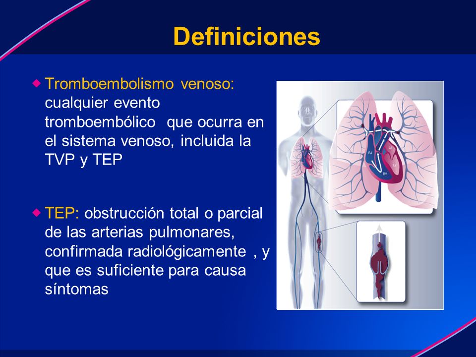 Definiciones Tromboembolismo venoso: cualquier evento tromboembólico que ocurra en el sistema venoso, incluida la TVP y TEP.
