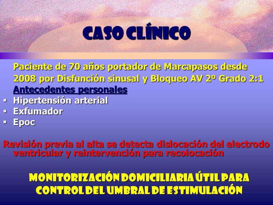 Caso clínico Paciente de 70 años portador de Marcapasos desde