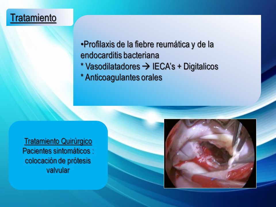 Tratamiento Profilaxis de la fiebre reumática y de la endocarditis bacteriana. * Vasodilatadores  IECA’s + Digitalicos.