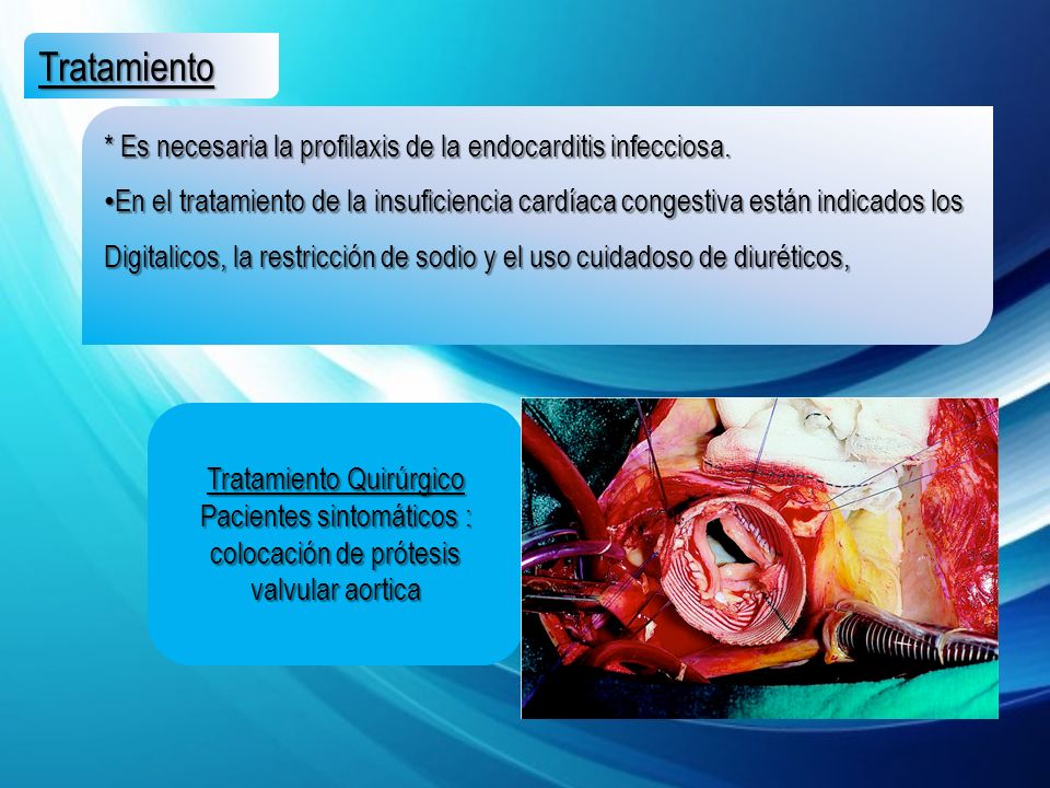 Tratamiento * Es necesaria la profilaxis de la endocarditis infecciosa.