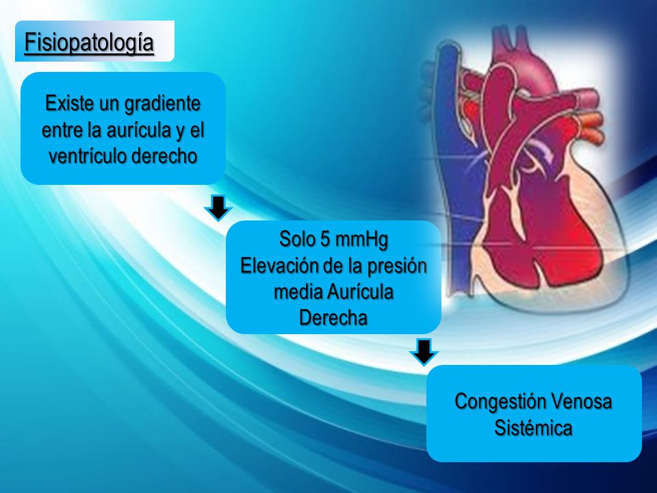 Fisiopatología Existe un gradiente entre la aurícula y el ventrículo derecho. Solo 5 mmHg. Elevación de la presión media Aurícula Derecha.