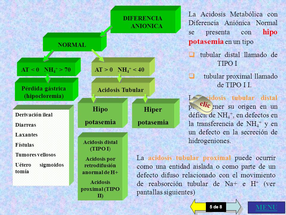 Acidosis por retrodifusión anormal de H+ Acidosis proximal (TIPO II)