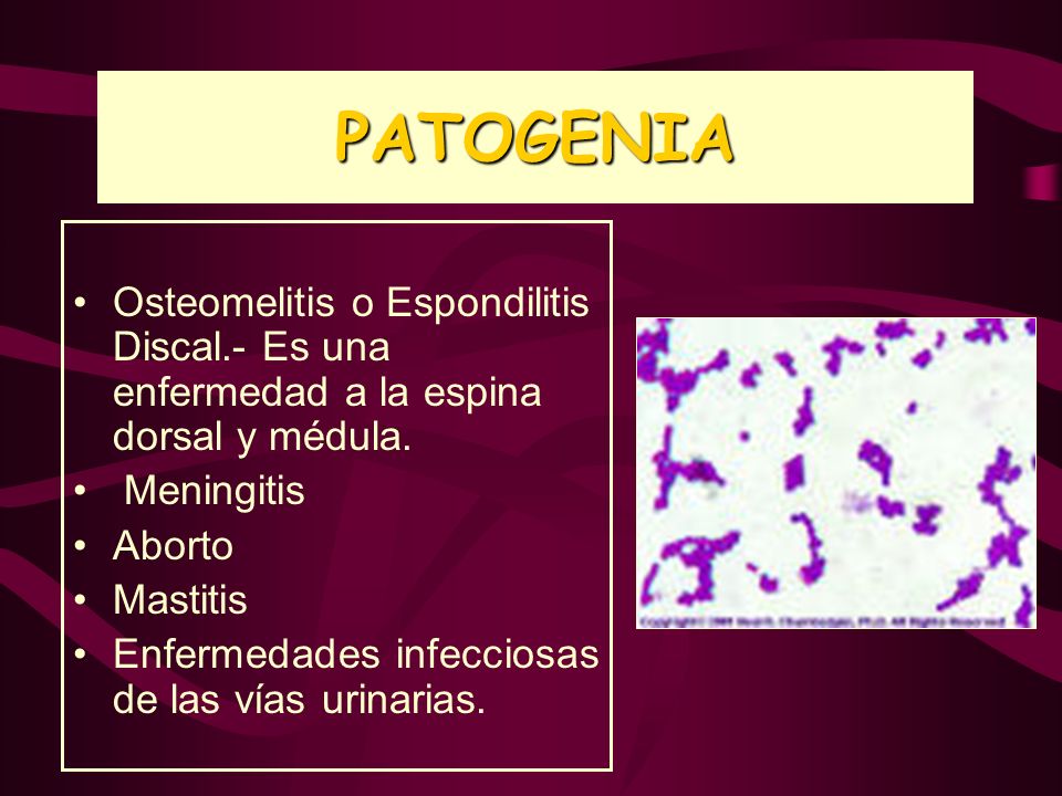 PATOGENIA Osteomelitis o Espondilitis Discal.- Es una enfermedad a la espina dorsal y médula. Meningitis.