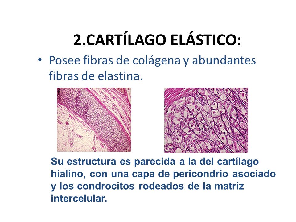 2.CARTÍLAGO ELÁSTICO: Posee fibras de colágena y abundantes fibras de elastina.