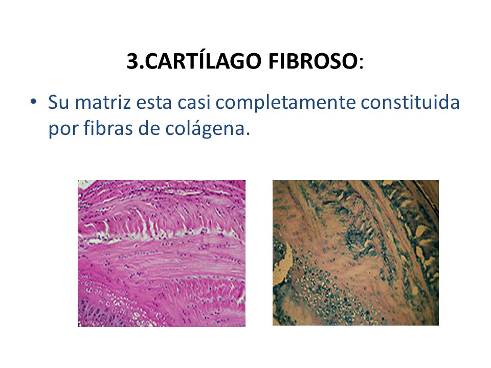 3.CARTÍLAGO FIBROSO: Su matriz esta casi completamente constituida por fibras de colágena.