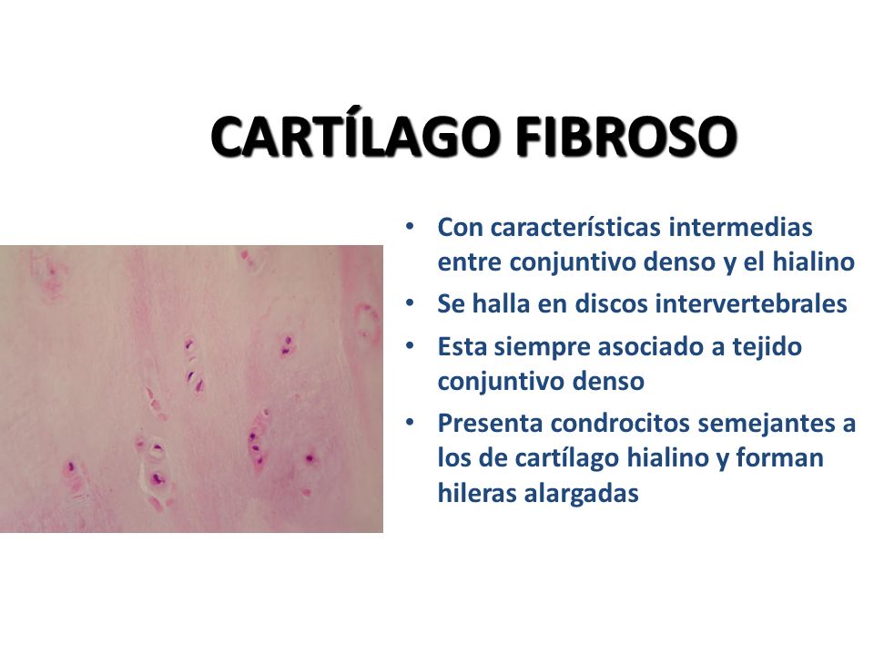 CARTÍLAGO FIBROSO Con características intermedias entre conjuntivo denso y el hialino. Se halla en discos intervertebrales.