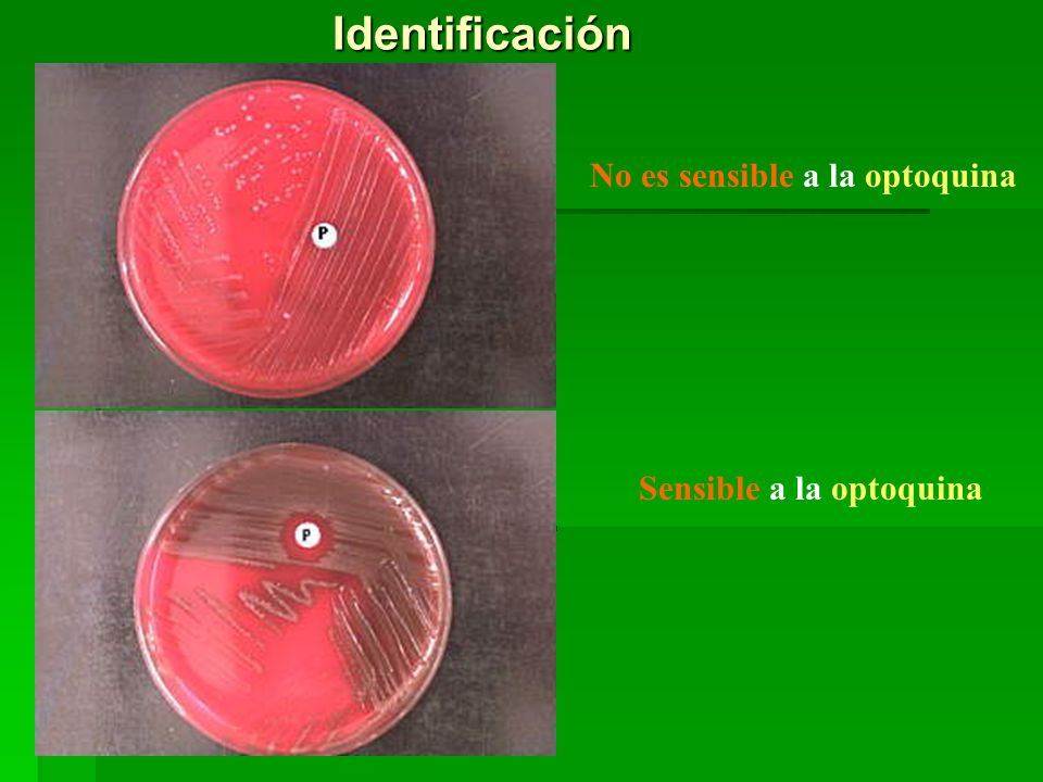 Identificación No es sensible a la optoquina Sensible a la optoquina
