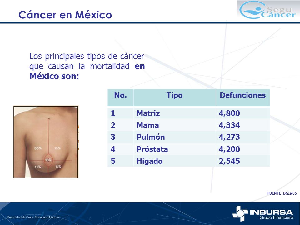 Cáncer en México Los principales tipos de cáncer que causan la mortalidad en México son: FUENTE: DGIS 05.
