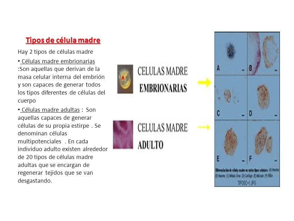 Tipos de célula madre Hay 2 tipos de células madre