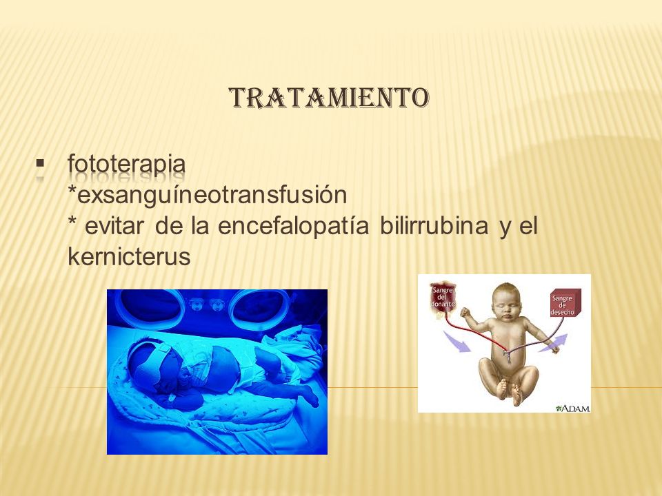 tratamiento fototerapia *exsanguíneotransfusión * evitar de la encefalopatía bilirrubina y el kernicterus.