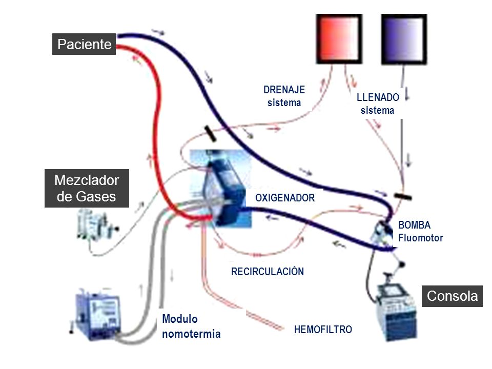 Paciente Mezclador de Gases Consola Modulo nomotermia DRENAJE sistema