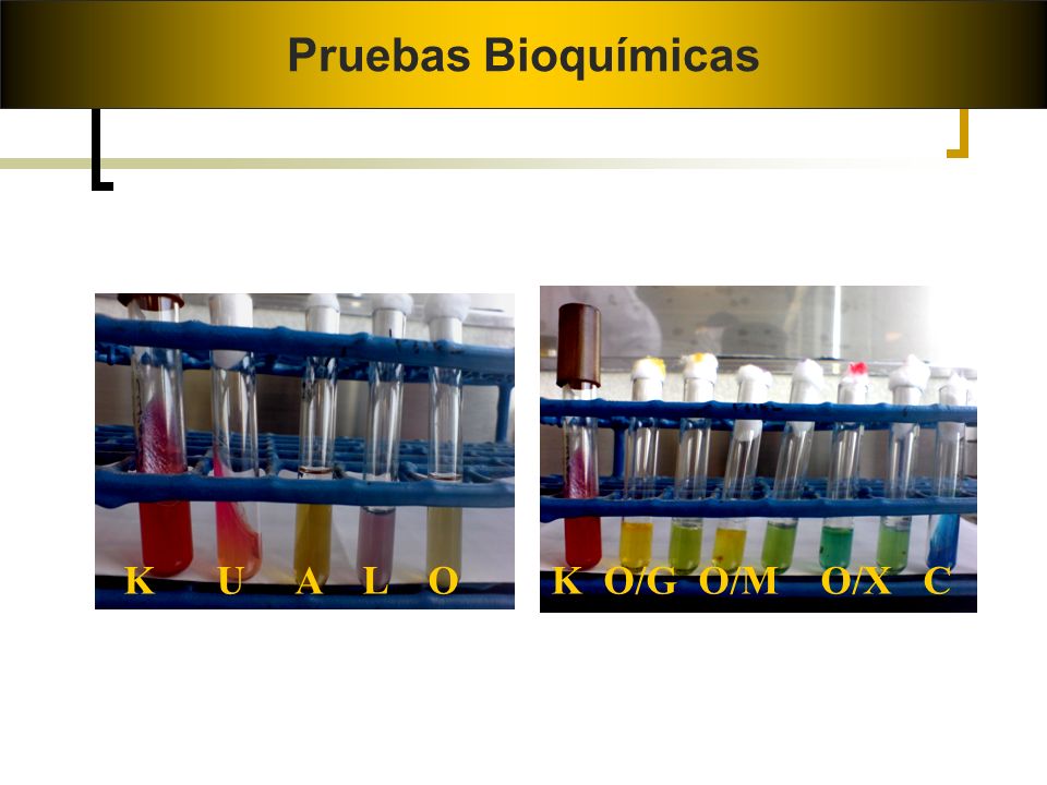 Pruebas Bioquímicas K U A L O K O/G O/M O/X C Burkholderia cepacia