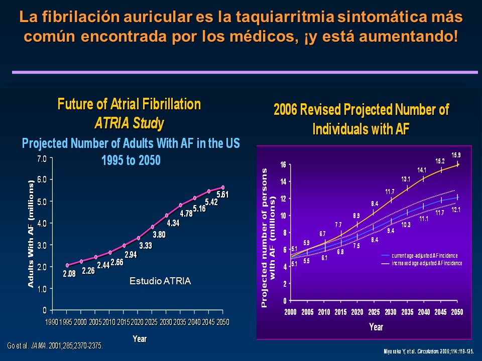 La fibrilación auricular es la taquiarritmia sintomática más común encontrada por los médicos, ¡y está aumentando!