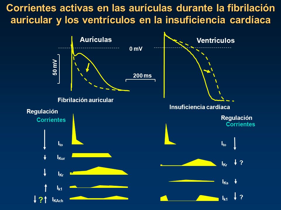Corrientes activas en las aurículas durante la fibrilación auricular y los ventrículos en la insuficiencia cardíaca