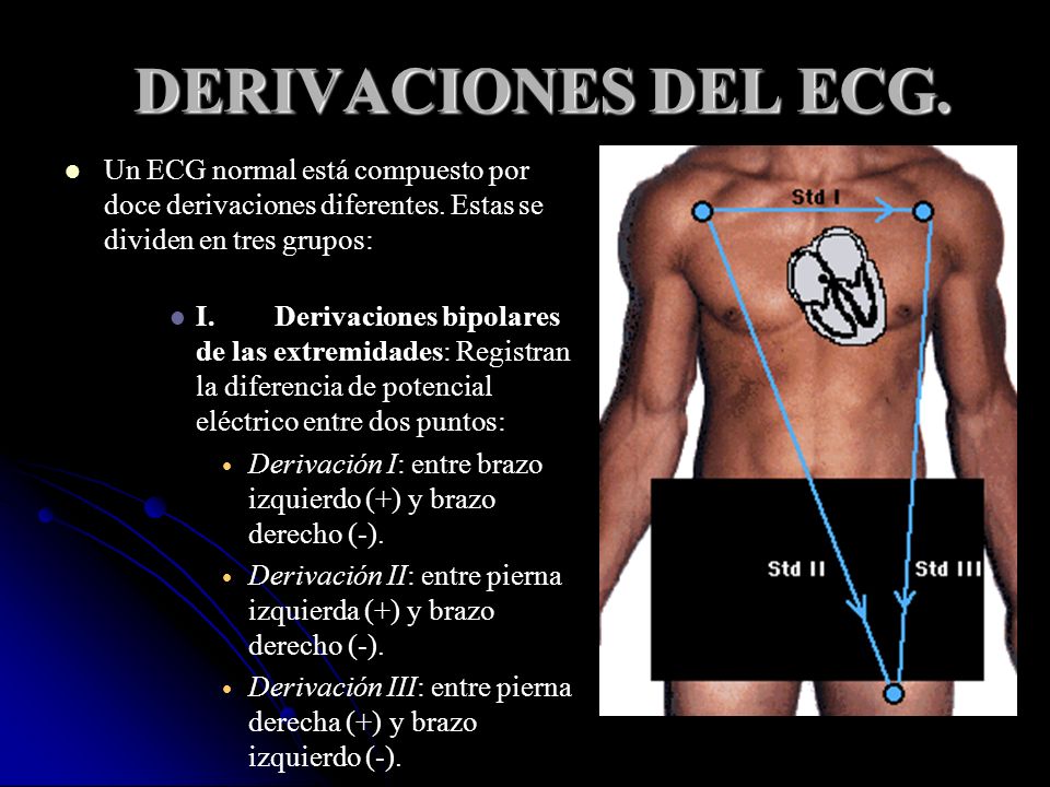 DERIVACIONES DEL ECG. Un ECG normal está compuesto por doce derivaciones diferentes. Estas se dividen en tres grupos: