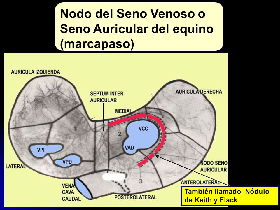 Nodo del Seno Venoso o Seno Auricular del equino (marcapaso)