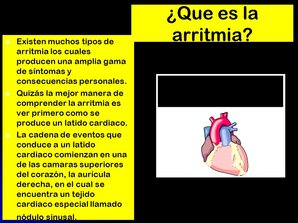 ¿Que es la arritmia Existen muchos tipos de arritmia los cuales producen una amplia gama de síntomas y consecuencias personales.