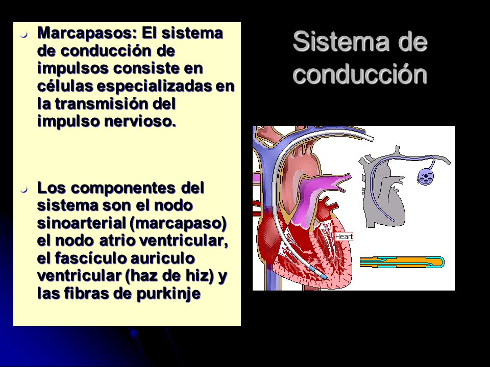 Marcapasos: El sistema de conducción de impulsos consiste en células especializadas en la transmisión del impulso nervioso.