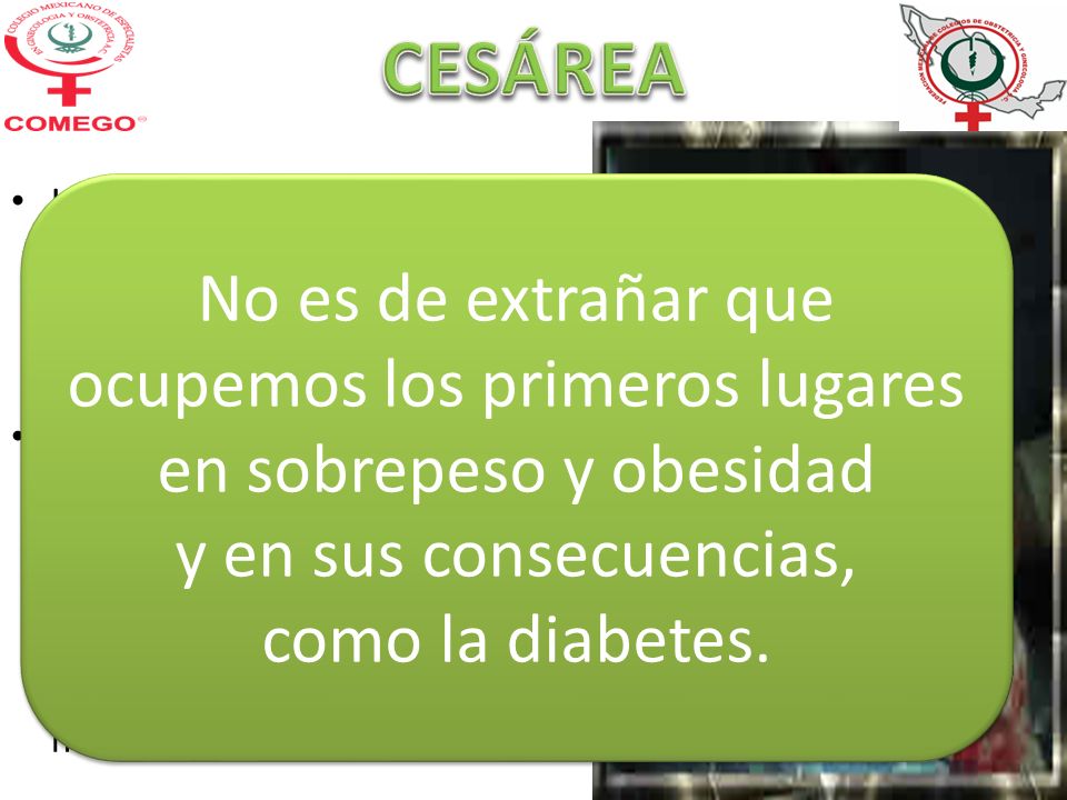 CESÁREA Los niños nacidos por cesárea presentaron el doble de obesidad a los tres años que los niños nacidos vía vaginal.