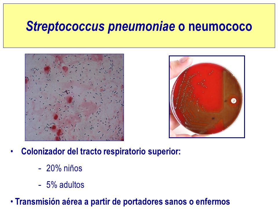 Streptococcus pneumoniae o neumococo.