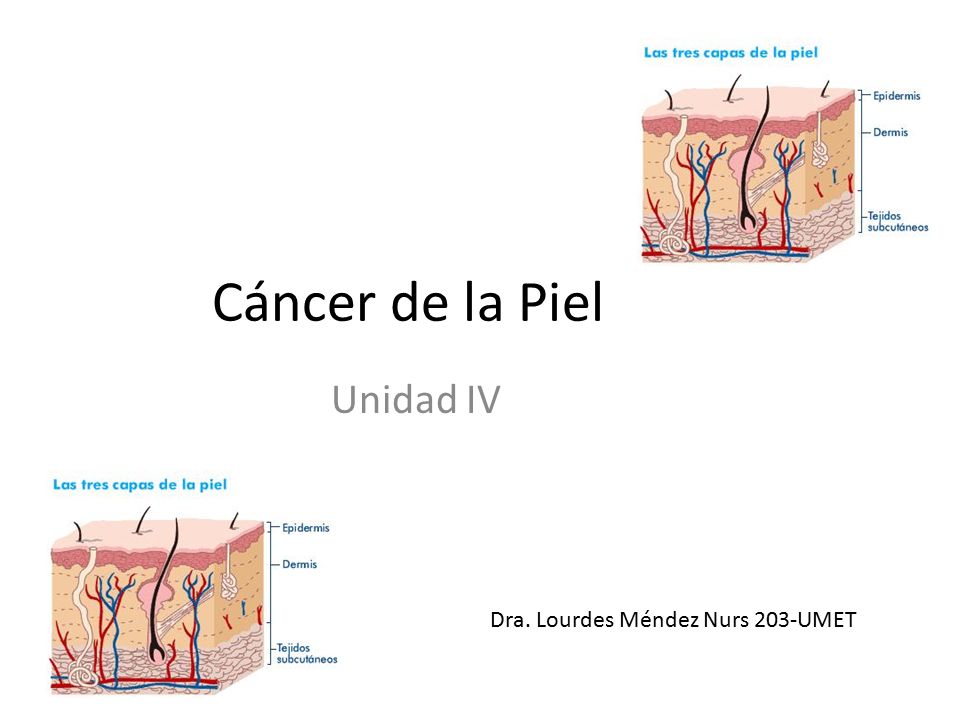 Cáncer de la Piel Unidad IV Dra. Lourdes Méndez Nurs 203-UMET