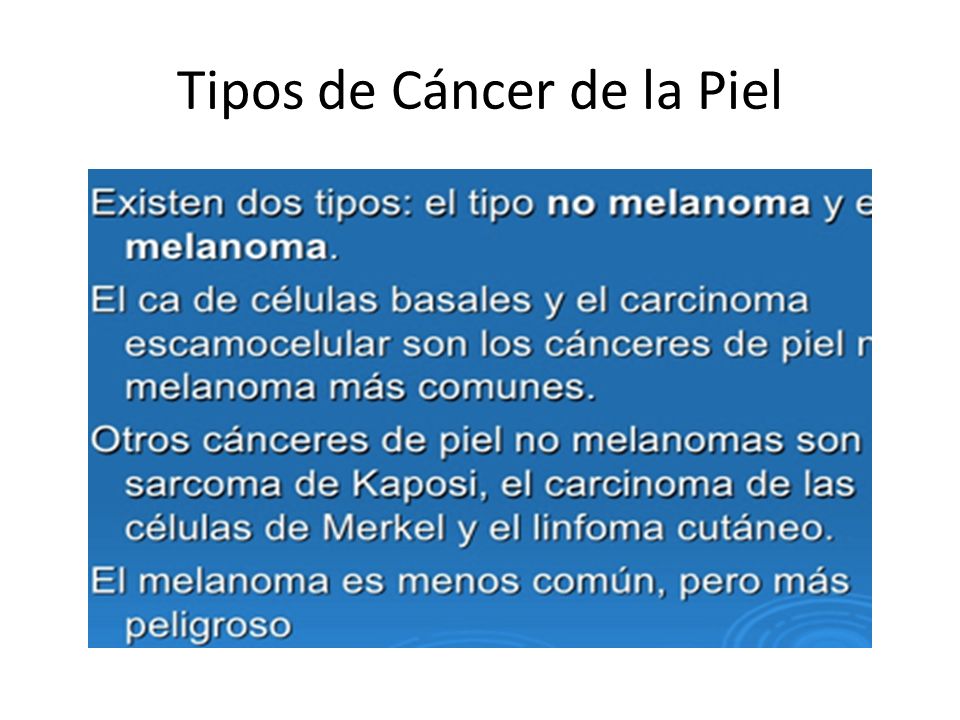 Tipos de Cáncer de la Piel