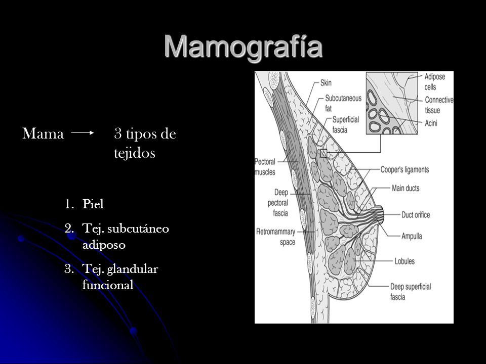 Mamografía Mama 3 tipos de tejidos Piel Tej. subcutáneo adiposo