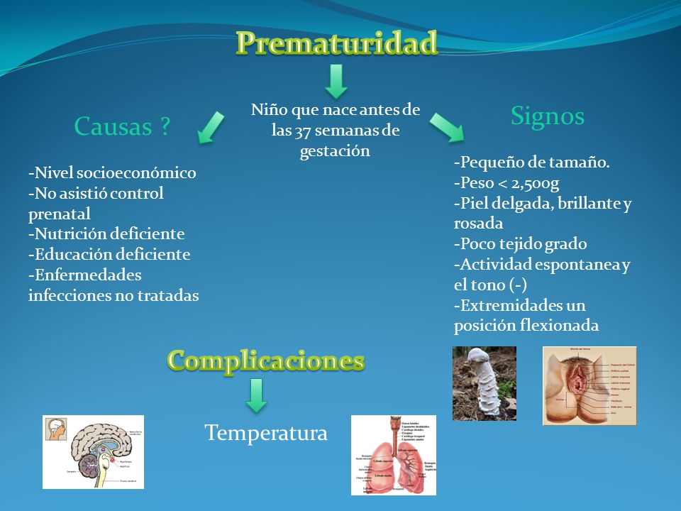 Niño que nace antes de las 37 semanas de gestación