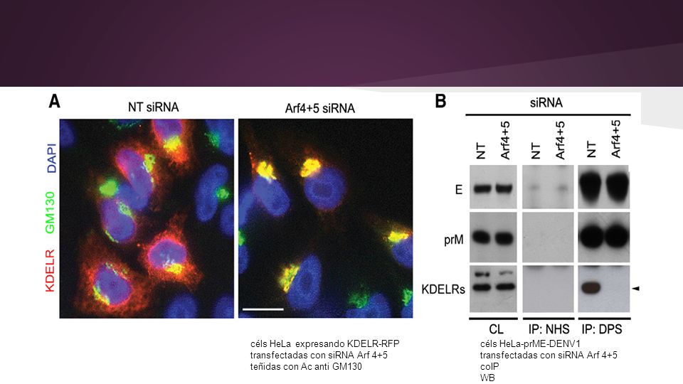 céls HeLa expresando KDELR-RFP transfectadas con siRNA Arf 4+5 teñidas con Ac anti GM130