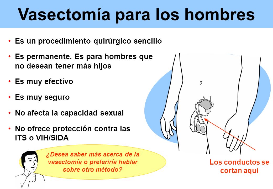 Vasectomía para los hombres Los conductos se cortan aquí