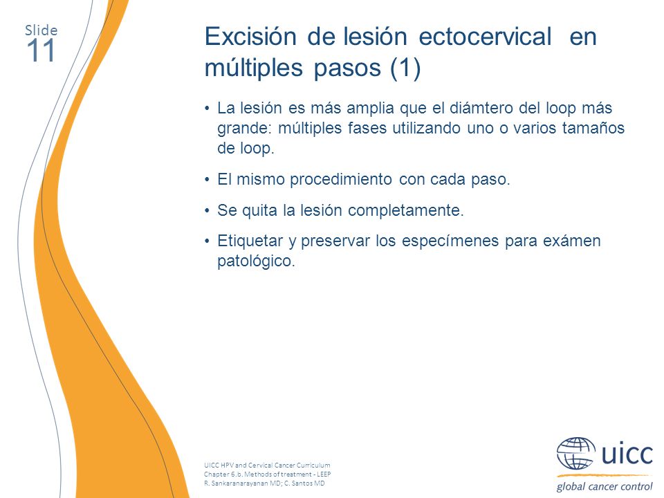 11 Excisión de lesión ectocervical en múltiples pasos (1) Slide