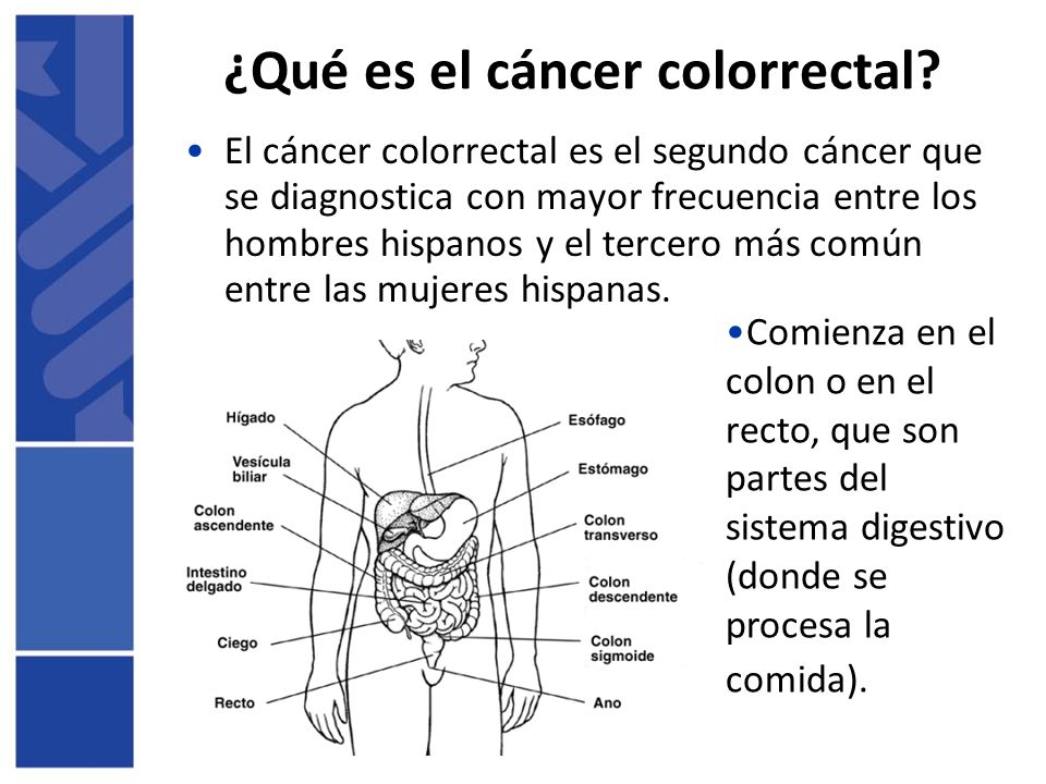 ¿Qué es el cáncer colorrectal