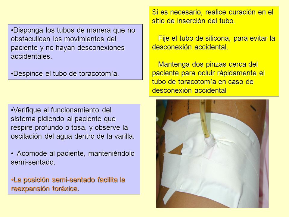 Si es necesario, realice curación en el sitio de inserción del tubo.