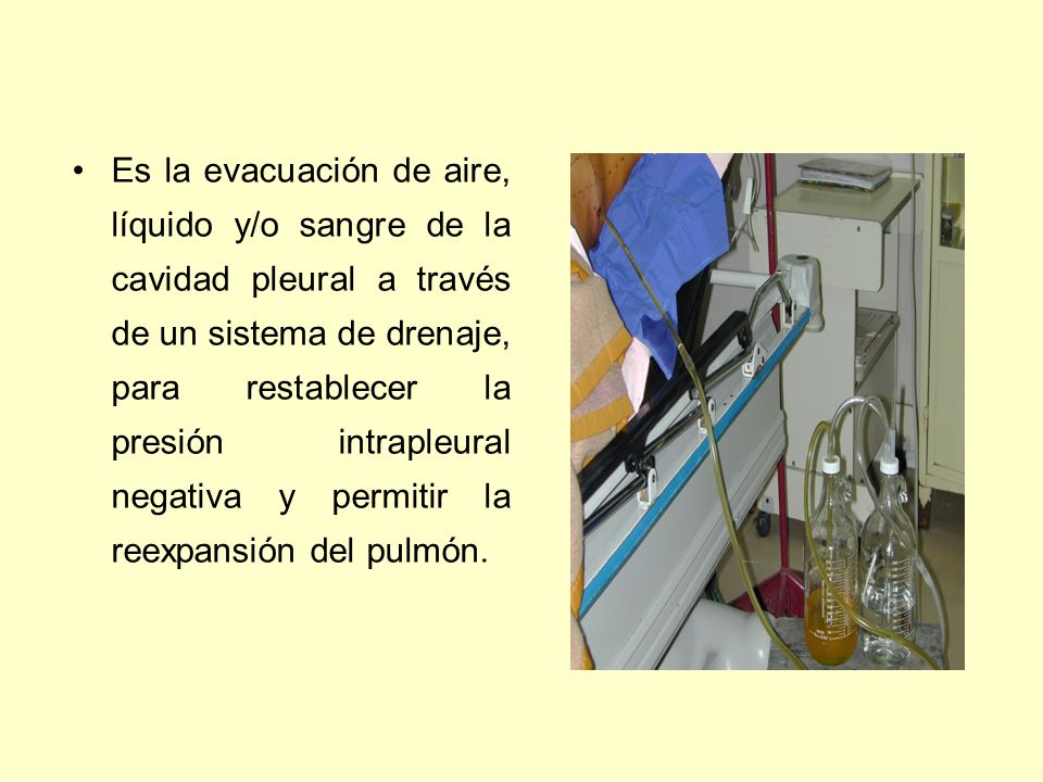 Es la evacuación de aire, líquido y/o sangre de la cavidad pleural a través de un sistema de drenaje, para restablecer la presión intrapleural negativa y permitir la reexpansión del pulmón.