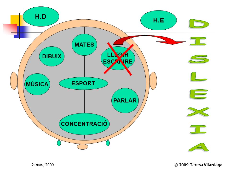 DISLEXIA H.D H.E MATES LLEGIR DIBUIX ESCRIURE MÚSICA ESPORT PARLAR