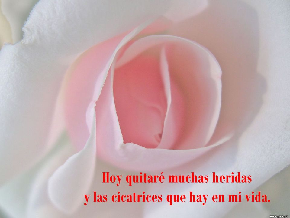 Hoy quitaré muchas heridas y las cicatrices que hay en mi vida.