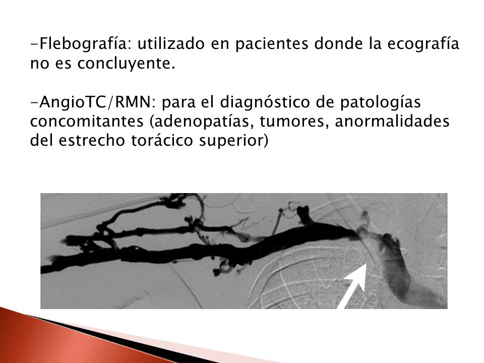 Flebografía: utilizado en pacientes donde la ecografía no es concluyente.