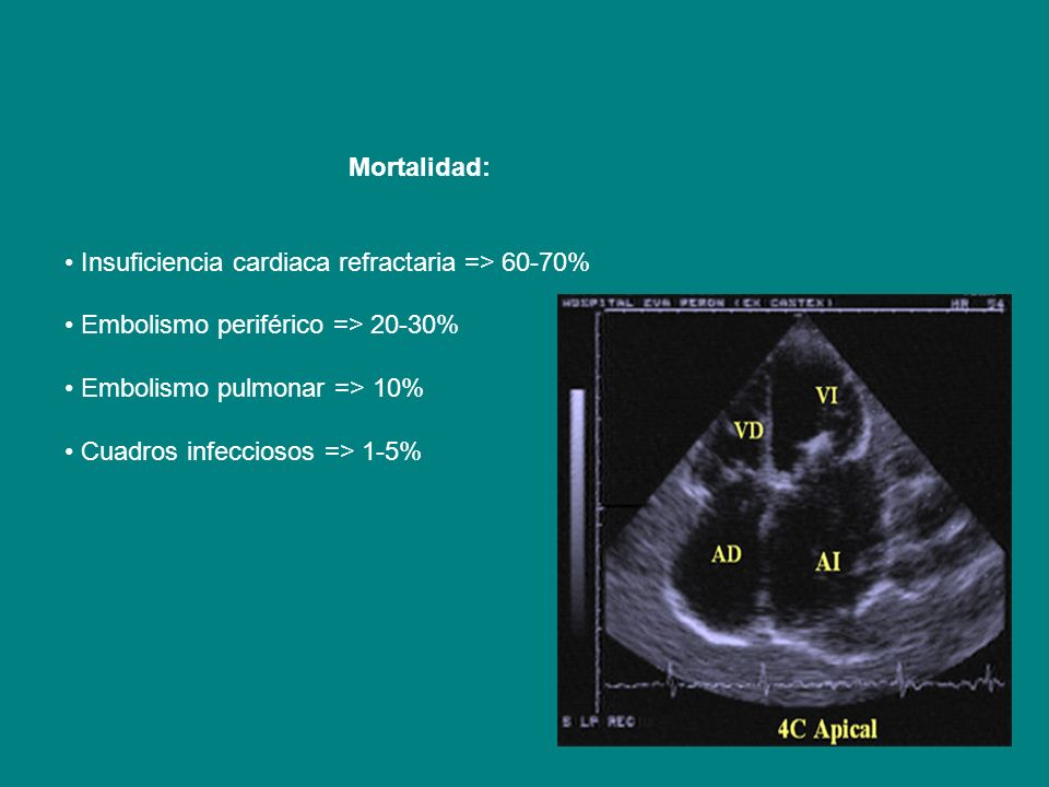 Mortalidad: • Insuficiencia cardiaca refractaria => 60-70% • Embolismo periférico => 20-30% • Embolismo pulmonar => 10%