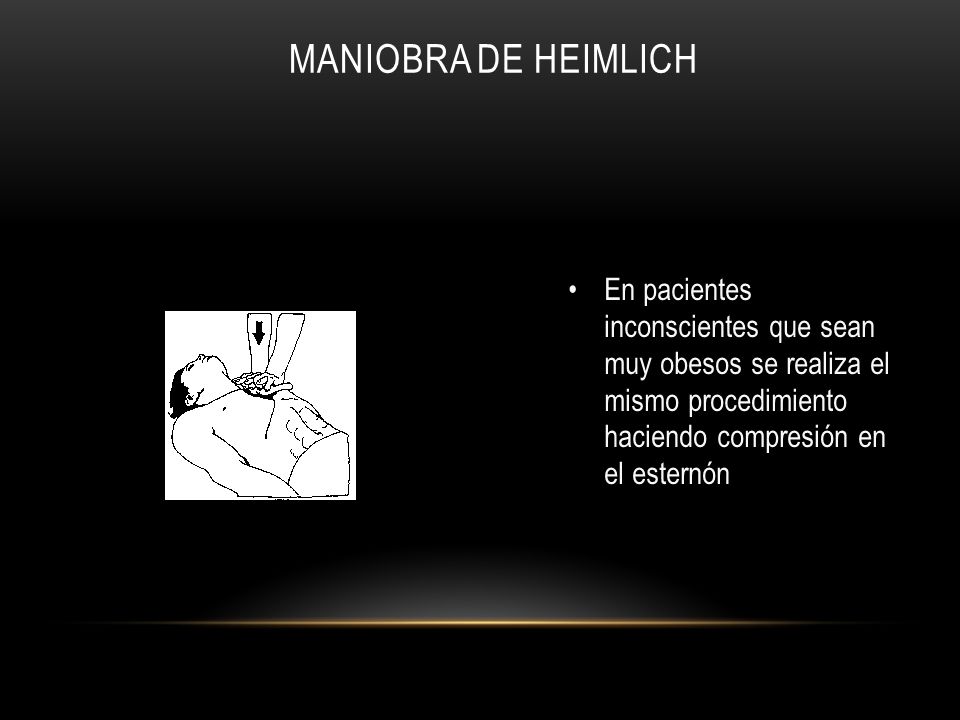 Maniobra de Heimlich En pacientes inconscientes que sean muy obesos se realiza el mismo procedimiento haciendo compresión en el esternón.