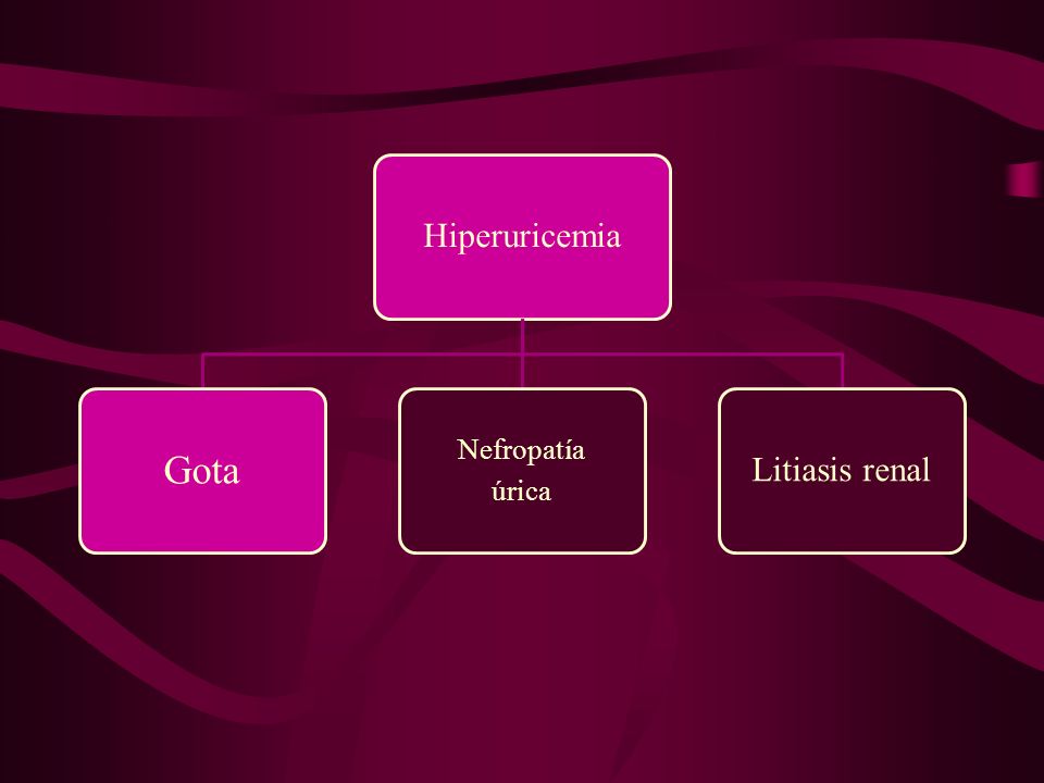 Hiperuricemia Gota Nefropatía úrica Litiasis renal