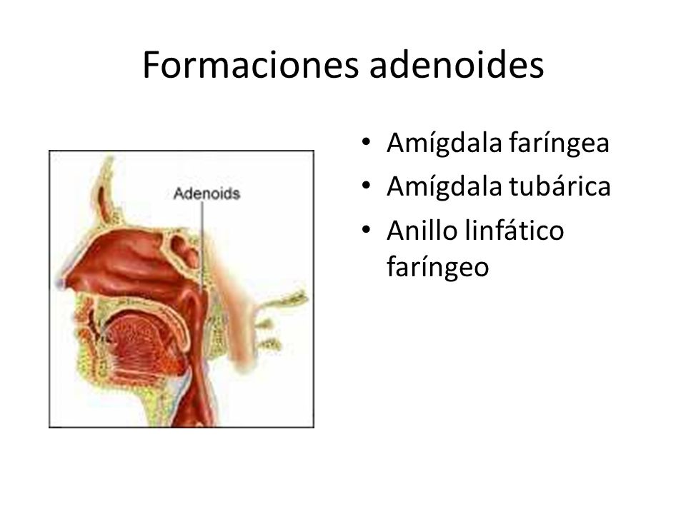 Formaciones adenoides