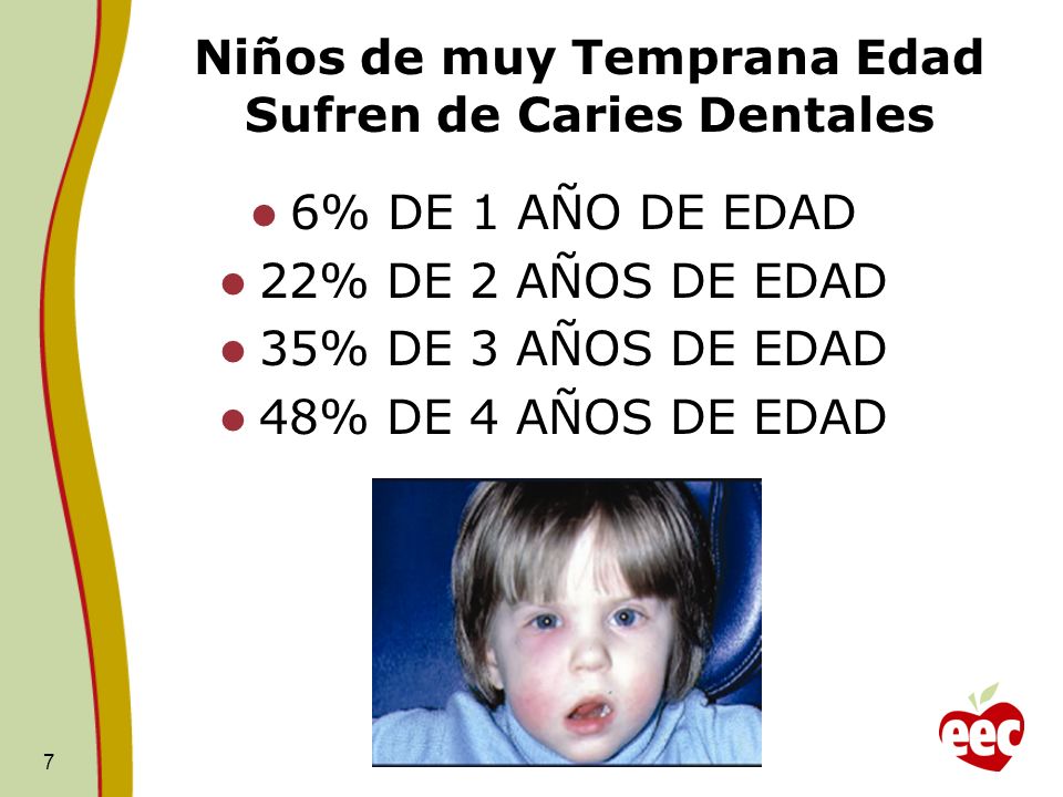 Niños de muy Temprana Edad Sufren de Caries Dentales