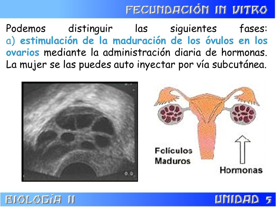 Podemos distinguir las siguientes fases: a) estimulación de la maduración de los óvulos en los ovarios mediante la administración diaria de hormonas.