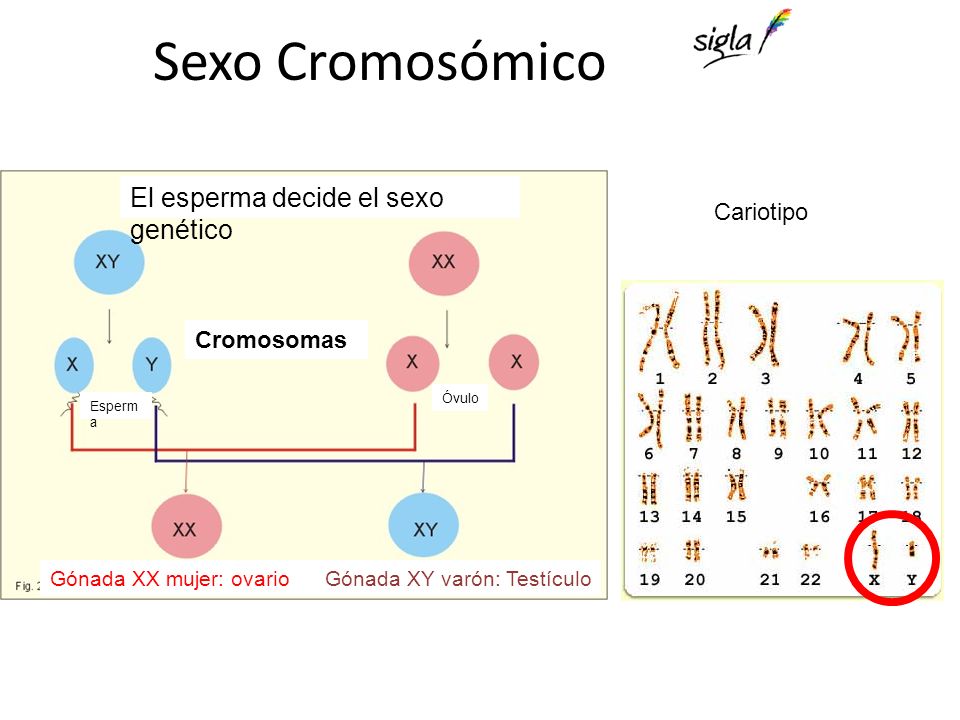 Sexo Cromosómico El esperma decide el sexo genético Cariotipo