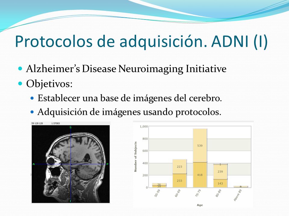 Protocolos de adquisición. ADNI (I)