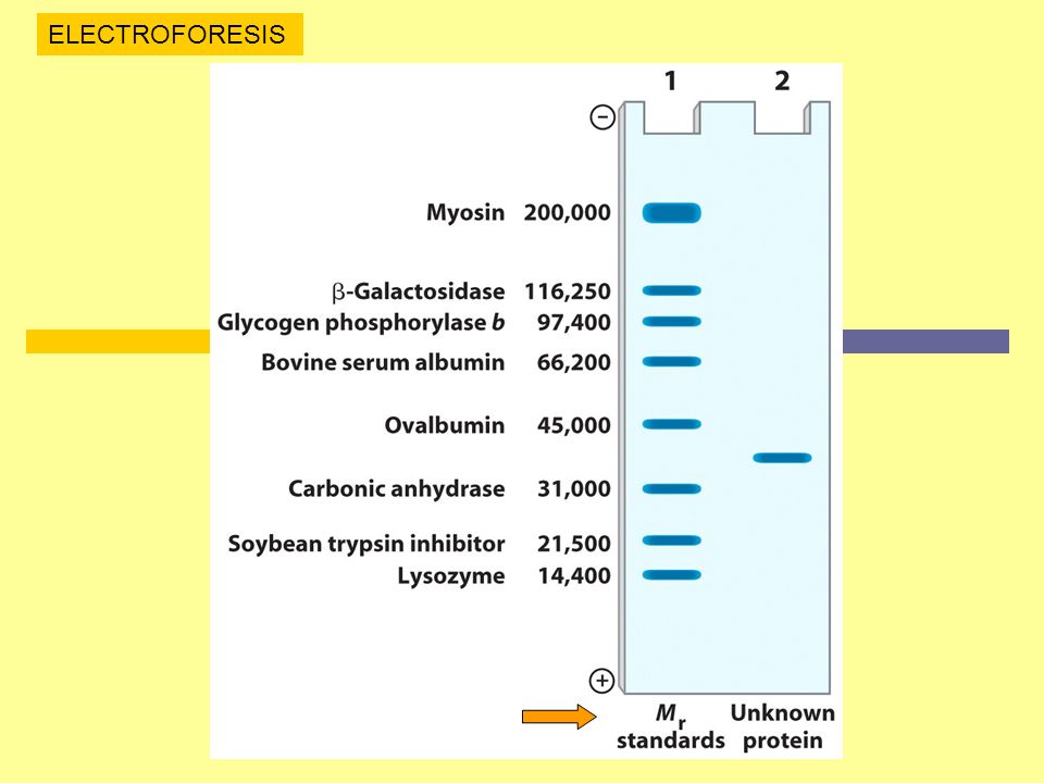 ELECTROFORESIS Pesos Moleculares